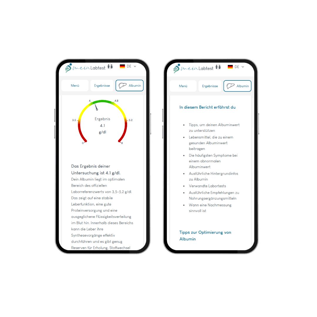 Zwei Smartphones mit Meinlabtest-Ergebnissen. Ergebnisse mit farbigen Balken. Logo Meinlabtest.