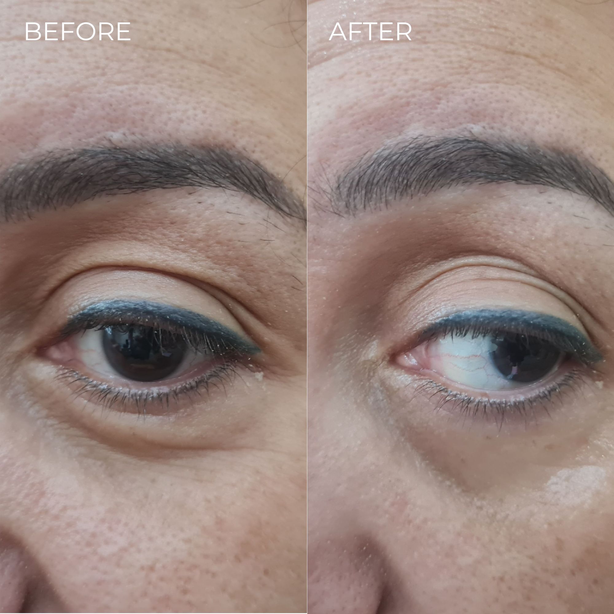 BEAUTICAL Sofort-Lifting Serum