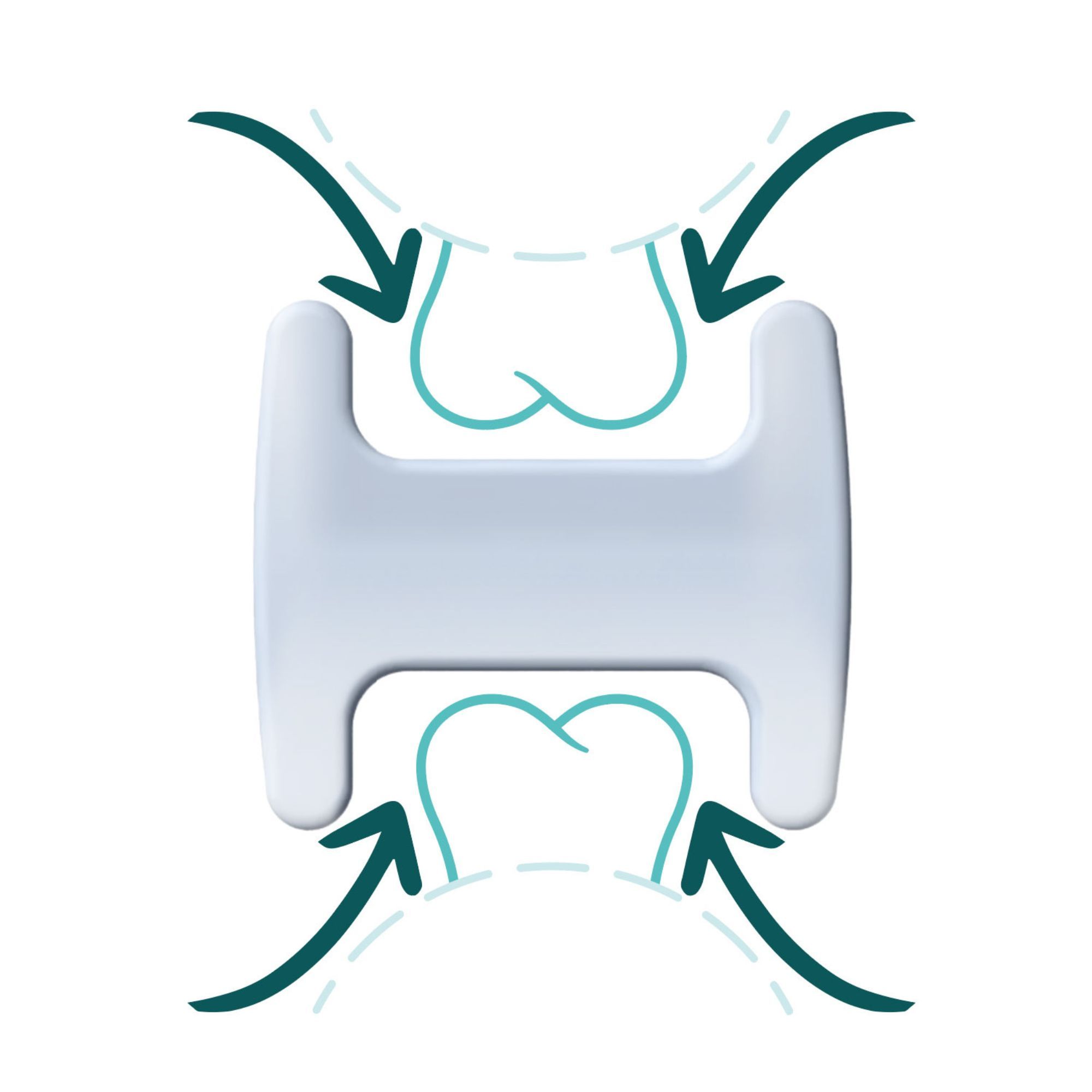 Illustration eines TJ-Motion Aligners zwischen Zähnen. Pfeile zeigen die Wirkung auf die Zähne.