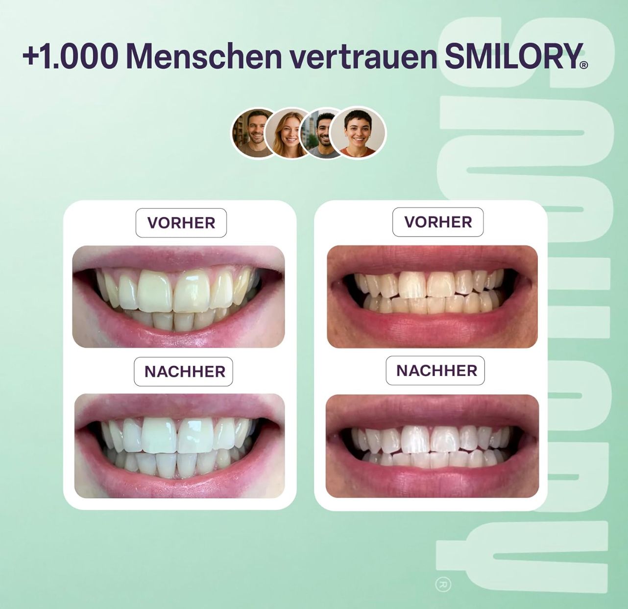 Vorher-Nachher-Vergleich von Zähnen, die mit Smilory White Show Gel behandelt wurden.