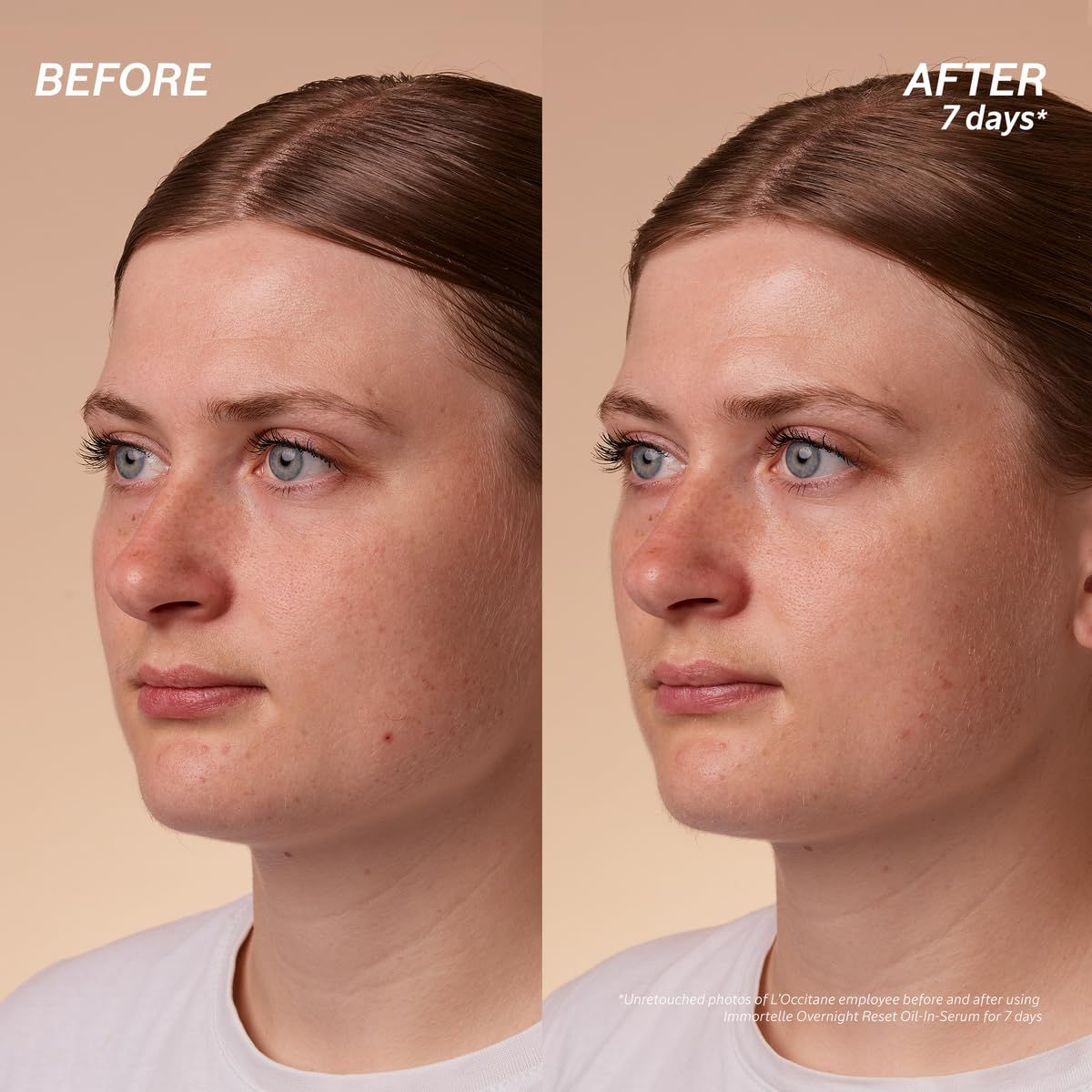 Vorher-Nachher-Vergleich. Frauengesicht, links vorher, rechts nach 7 Tagen. Text: Overnight Reset Öl-in-Serum.