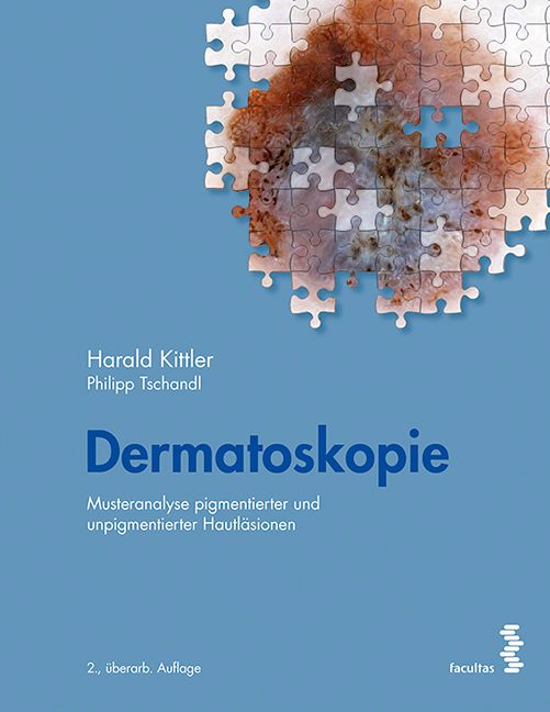 Buchcover mit blauem Hintergrund. Titel: Dermatoskopie. Autoren: Harald Kittler, Philipp Tschandl. Untertitel: Musteranalyse pigmentierter und unpigmentierter Hautläsionen.
