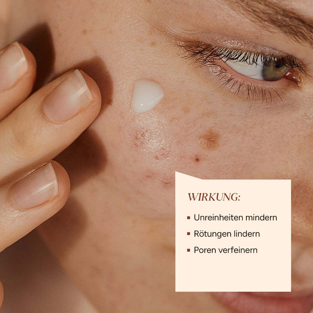 Nahaufnahme einer Hand, die Serum auf das Gesicht aufträgt. Text: Unreinheiten mindern, Rötungen lindern, Poren verfeinern.