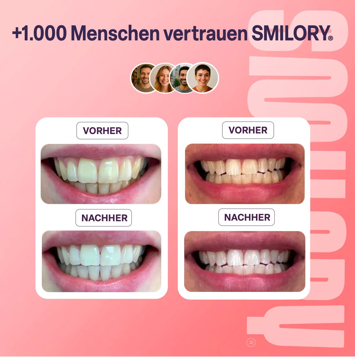 Vorher-Nachher-Vergleich von Zähnen. Zwei Paare von Bildern zeigen Unterschiede. Text: +1.000 Menschen vertrauen SMILORY.