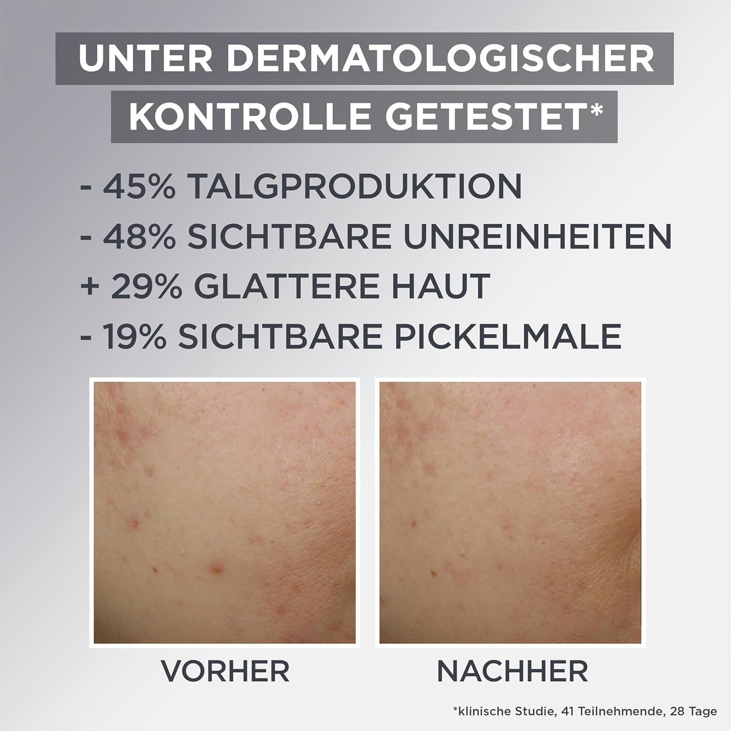 Garnier Gesichtscreme SkinActive AHA+BHA mit Kohle 3in1