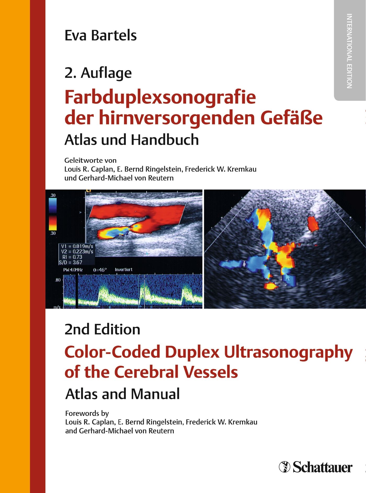 Buchcover: Farbduplexsonografie der hirnversorgenden Gefäße. Titel, Autoren, medizinische Abbildungen, 2. Auflage, Schattauer Verlag.