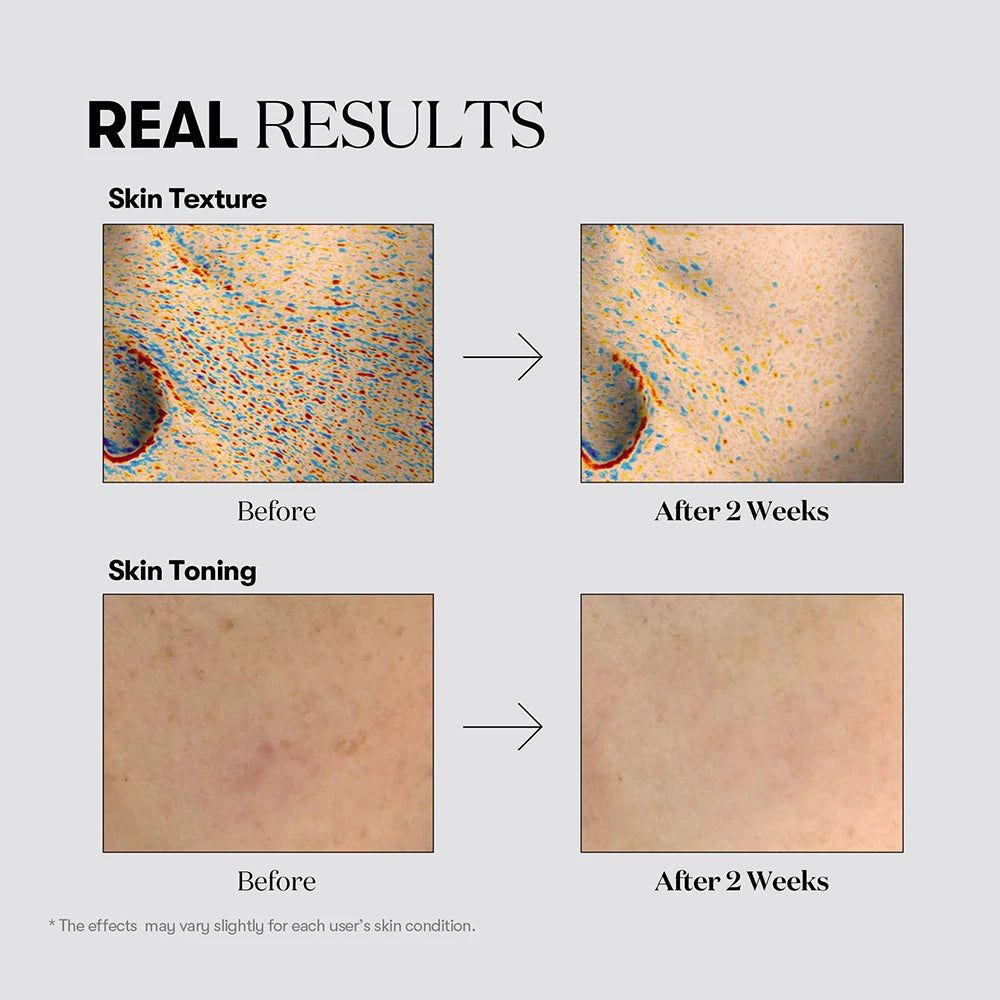 VT COSMETICS TX-Toning: Vorher-Nachher-Vergleich der Hauttextur und Tönung.