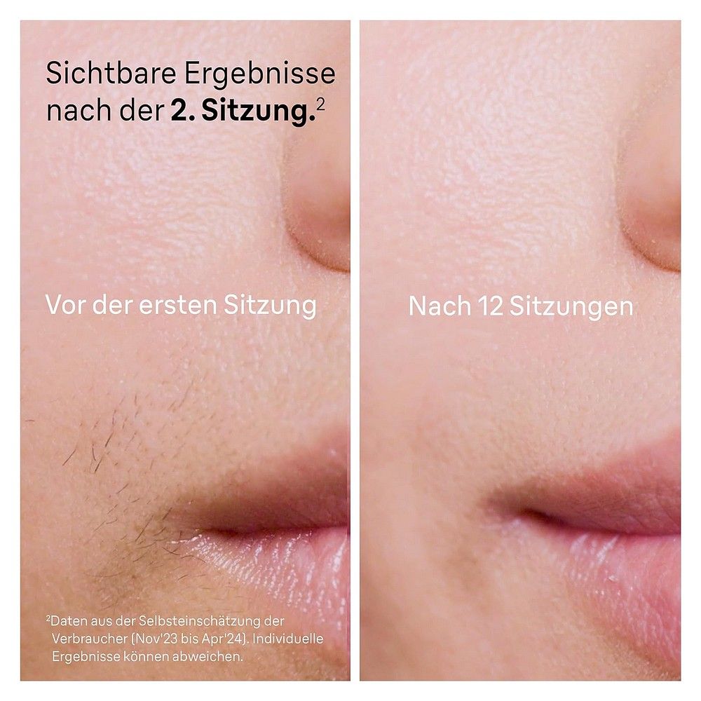 Braun Silk-expert Pro PL5160 IPL-Haarentfernungsgerät