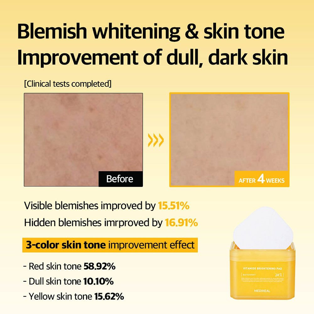 Vorher/Nachher-Vergleich von Hautverbesserungen durch MEDIHEAL Vitamide Brightening Pad. Ergebnisse werden in Prozent angezeigt.