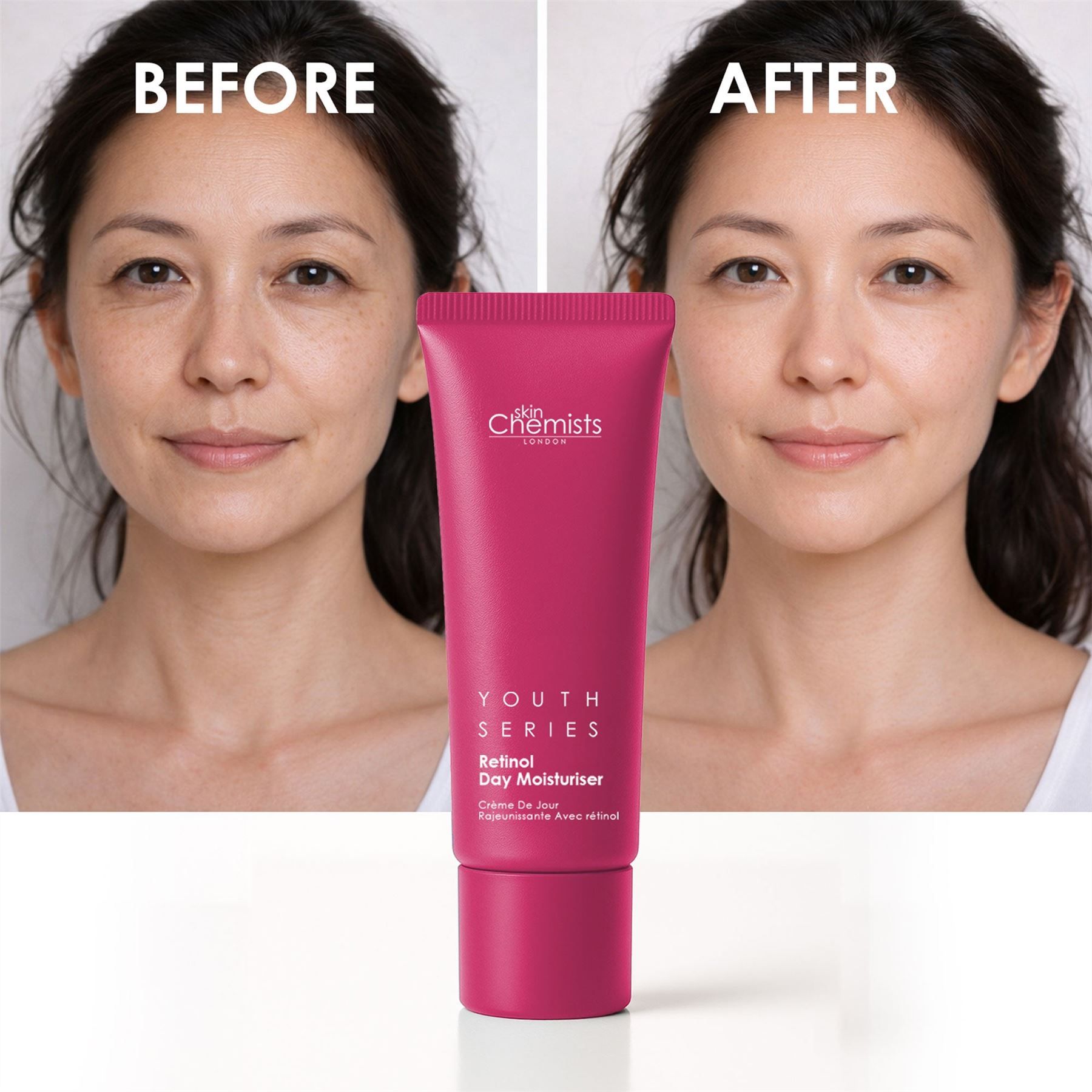 Vorher-Nachher-Vergleich einer Frau, die SkinChemists Retinol & Bakuchiol Tagescreme verwendet.