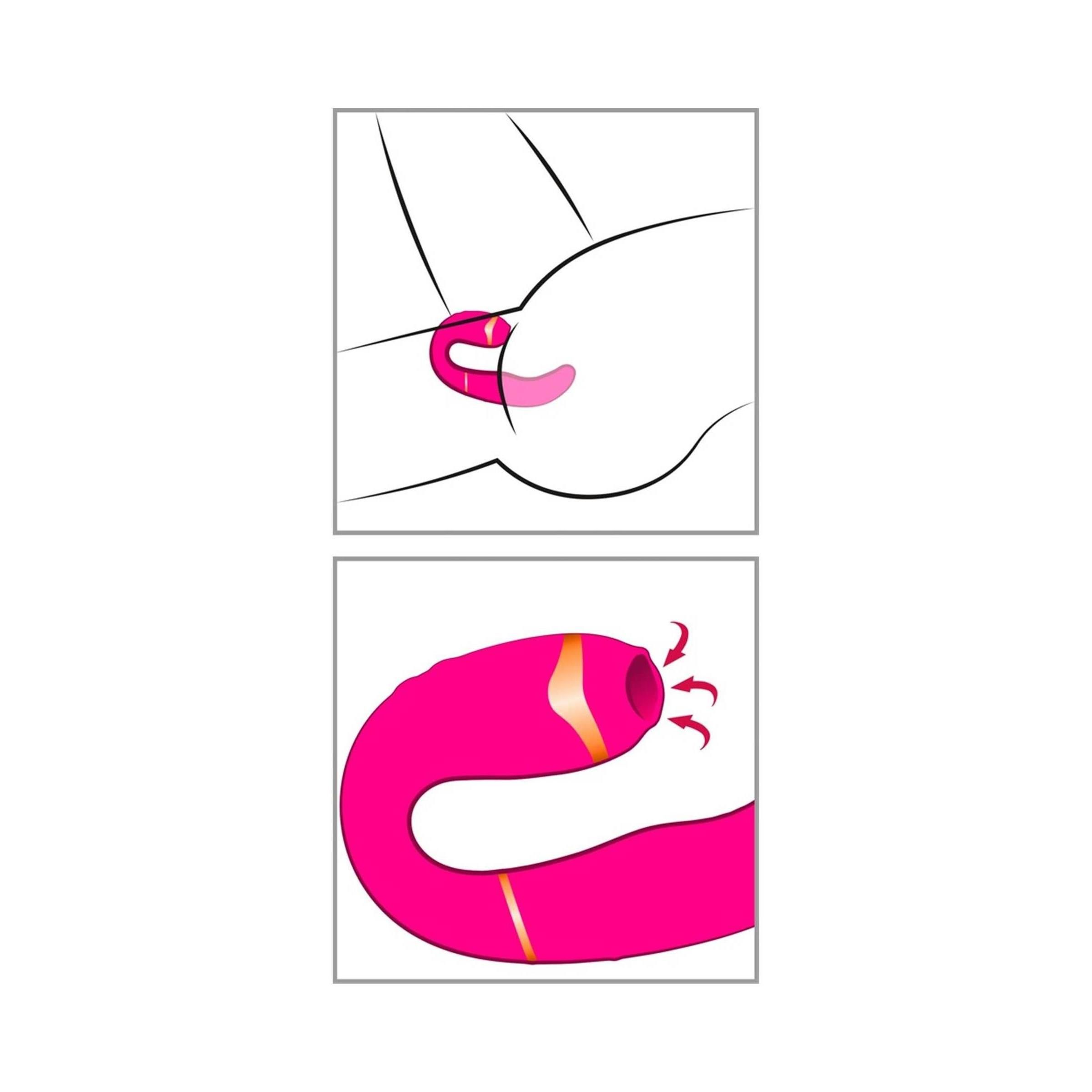 Zwei Illustrationen. Oben: Anwendung. Unten: Vibrator mit Saugfunktion. Pfeile zeigen die Saugrichtung.