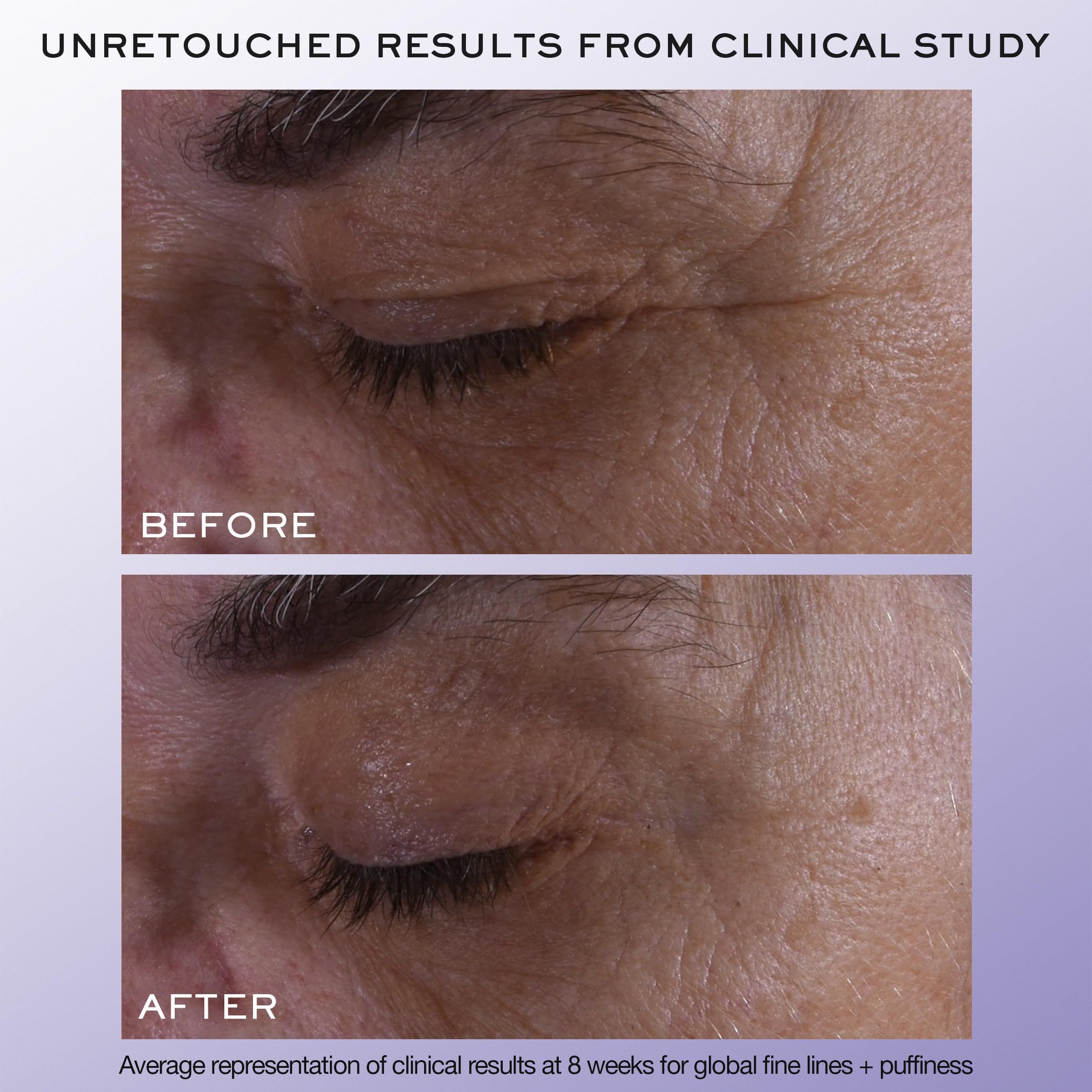 Lancôme, Rénergie H.C.F. Triple Eye Serum