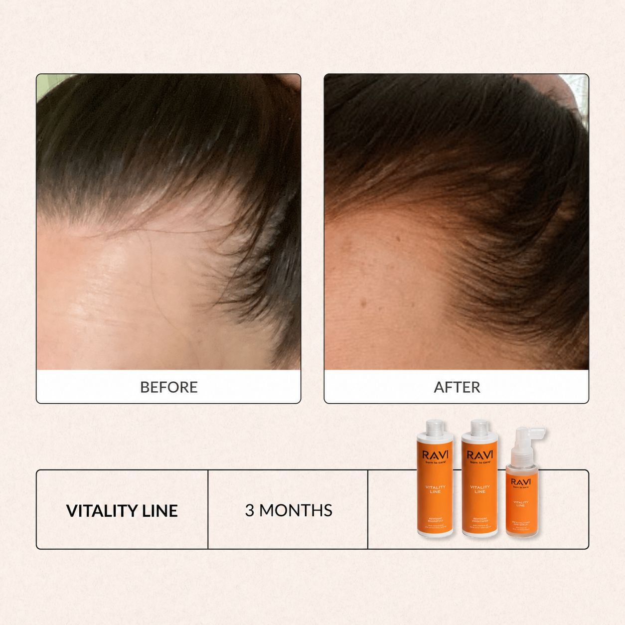 Vorher-Nachher-Vergleich von Haaren nach 3 Monaten mit RAVI Vitality Line.