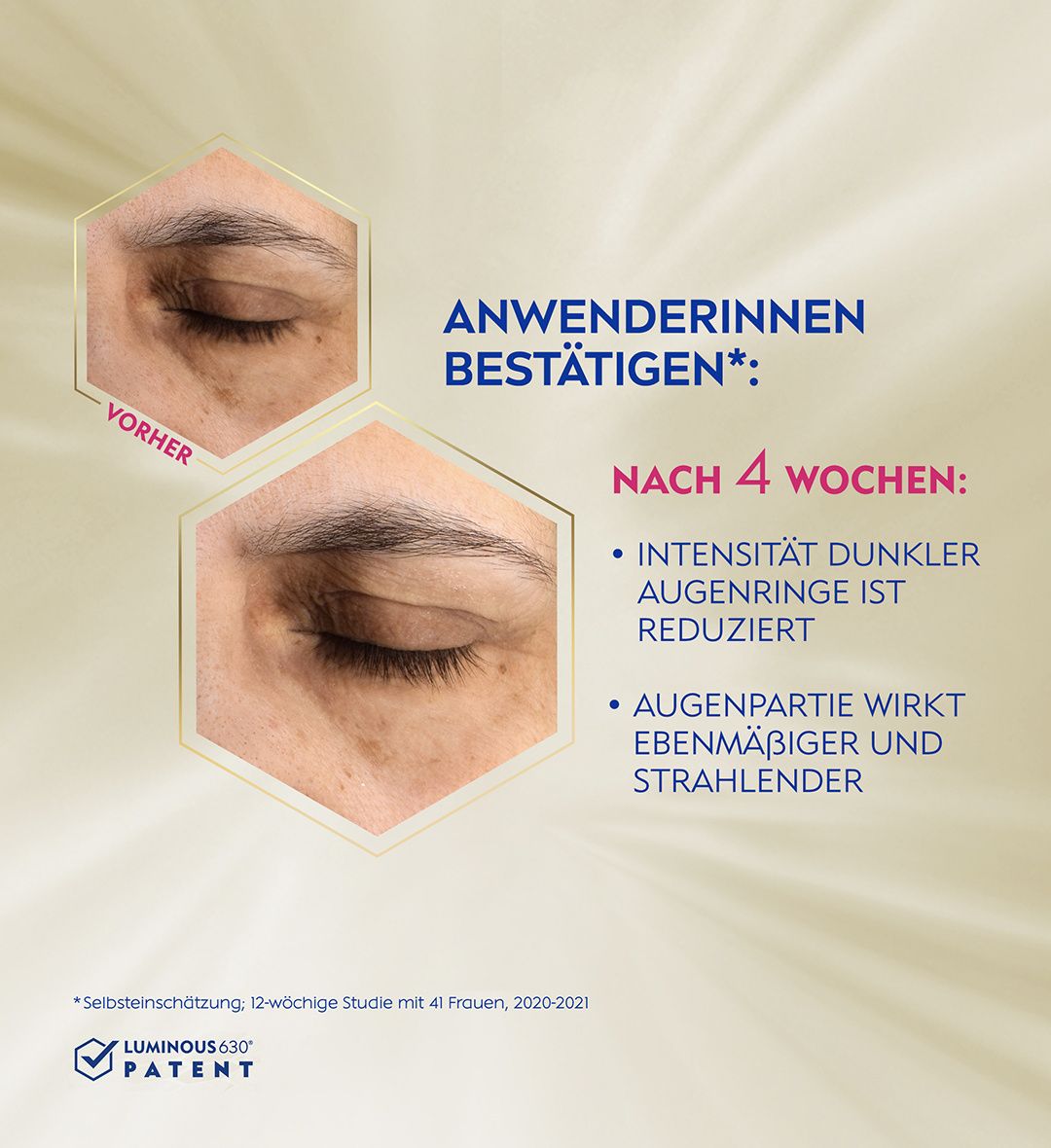 NIVEA Cellular LUMINOUS630 Anti-Pigmentflecken Augenpflege