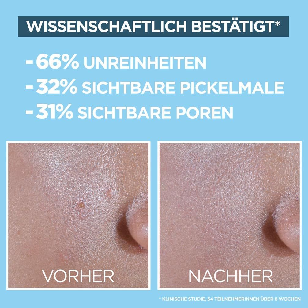 Vorher/Nachher-Vergleich. Hautpartien. Text: -66% Unreinheiten, -32% sichtbare Pickelmale, -31% sichtbare Poren.