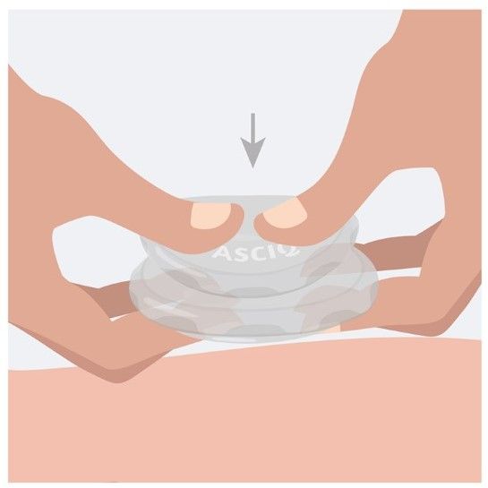 FASCIQ® Silikon Schröpf Set 4 St., Komplettsatz cupping