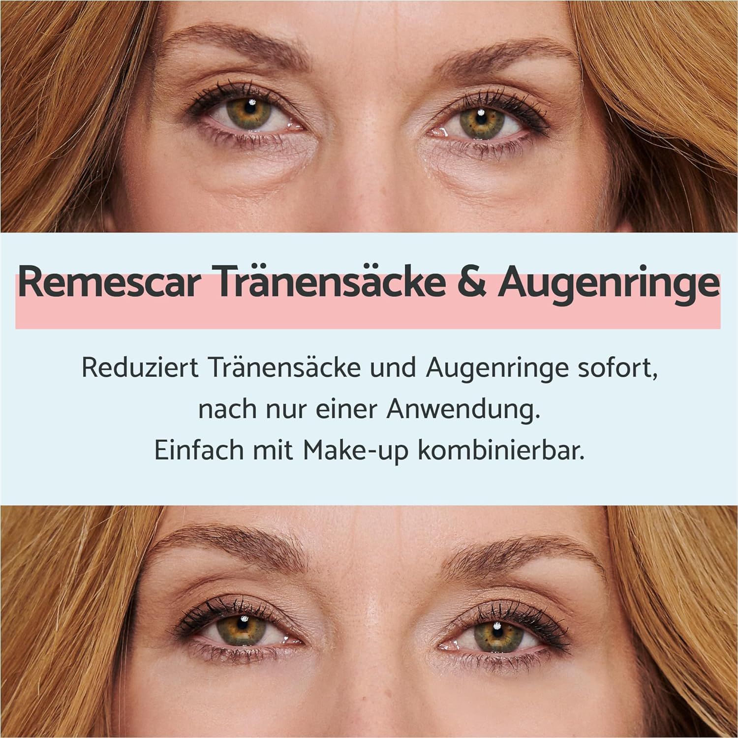 Remescar Eye Bags & Dark Circles