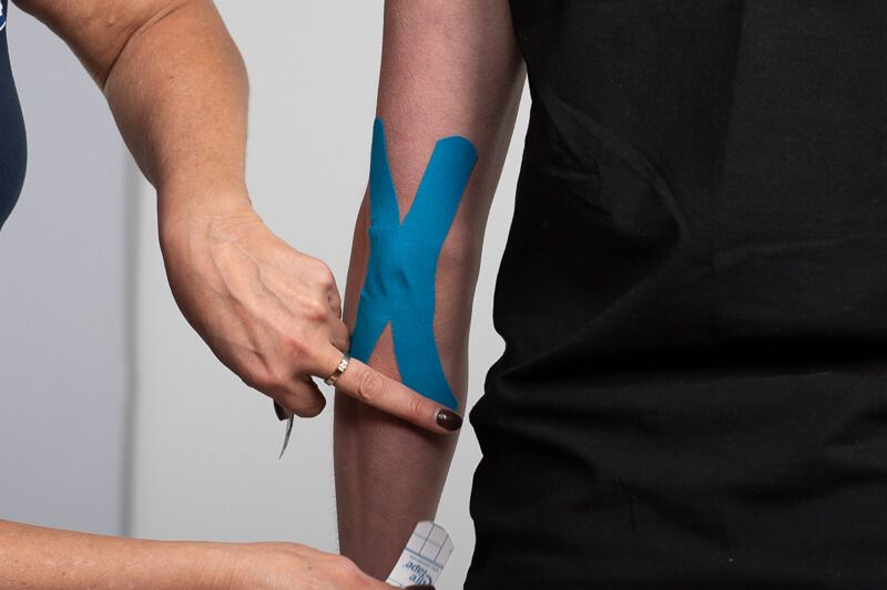 Blaues Kinesiotape in X-Form auf einem Arm angebracht.