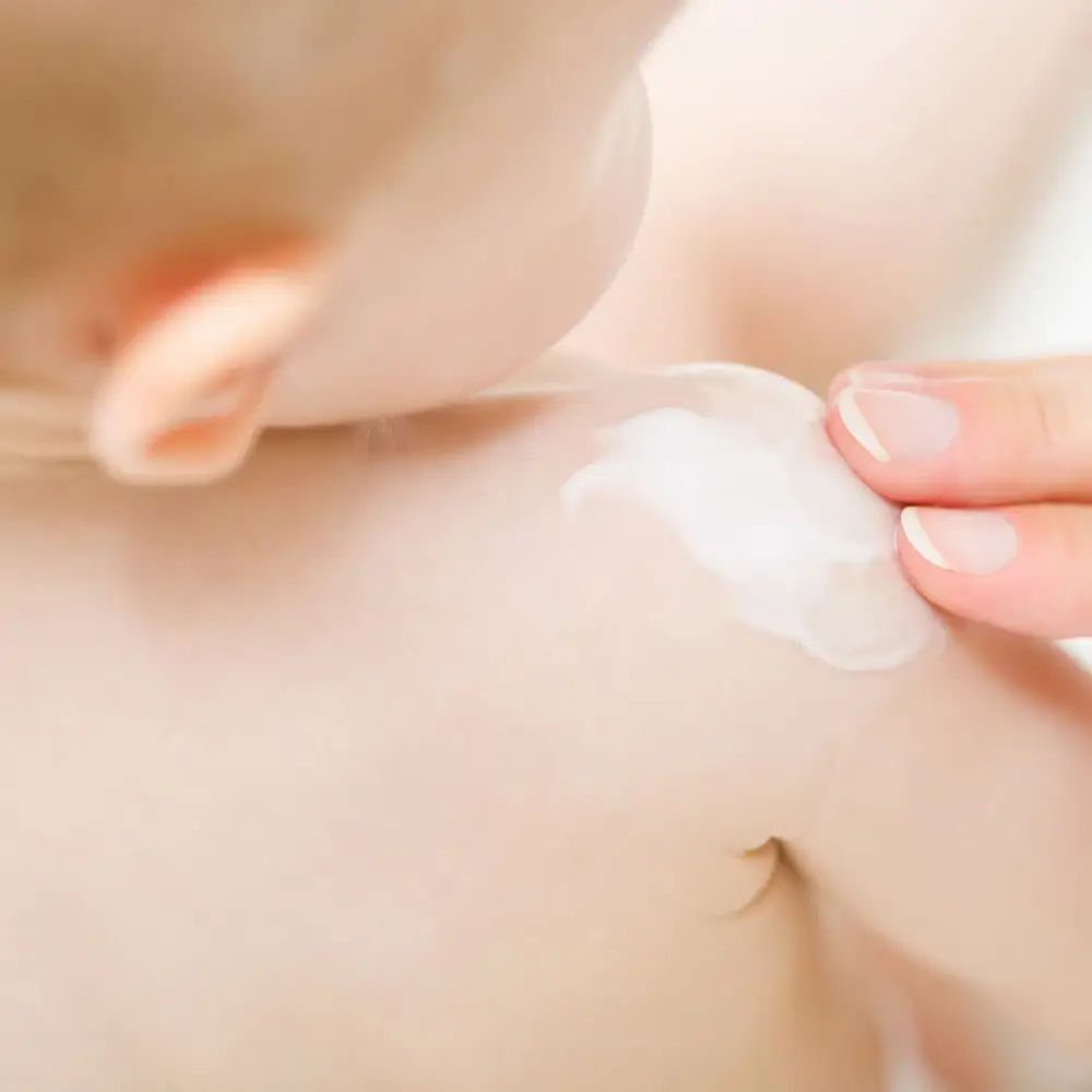 Nahaufnahme eines Babys. Eine Hand trägt Creme auf die Schulter des Babys auf.