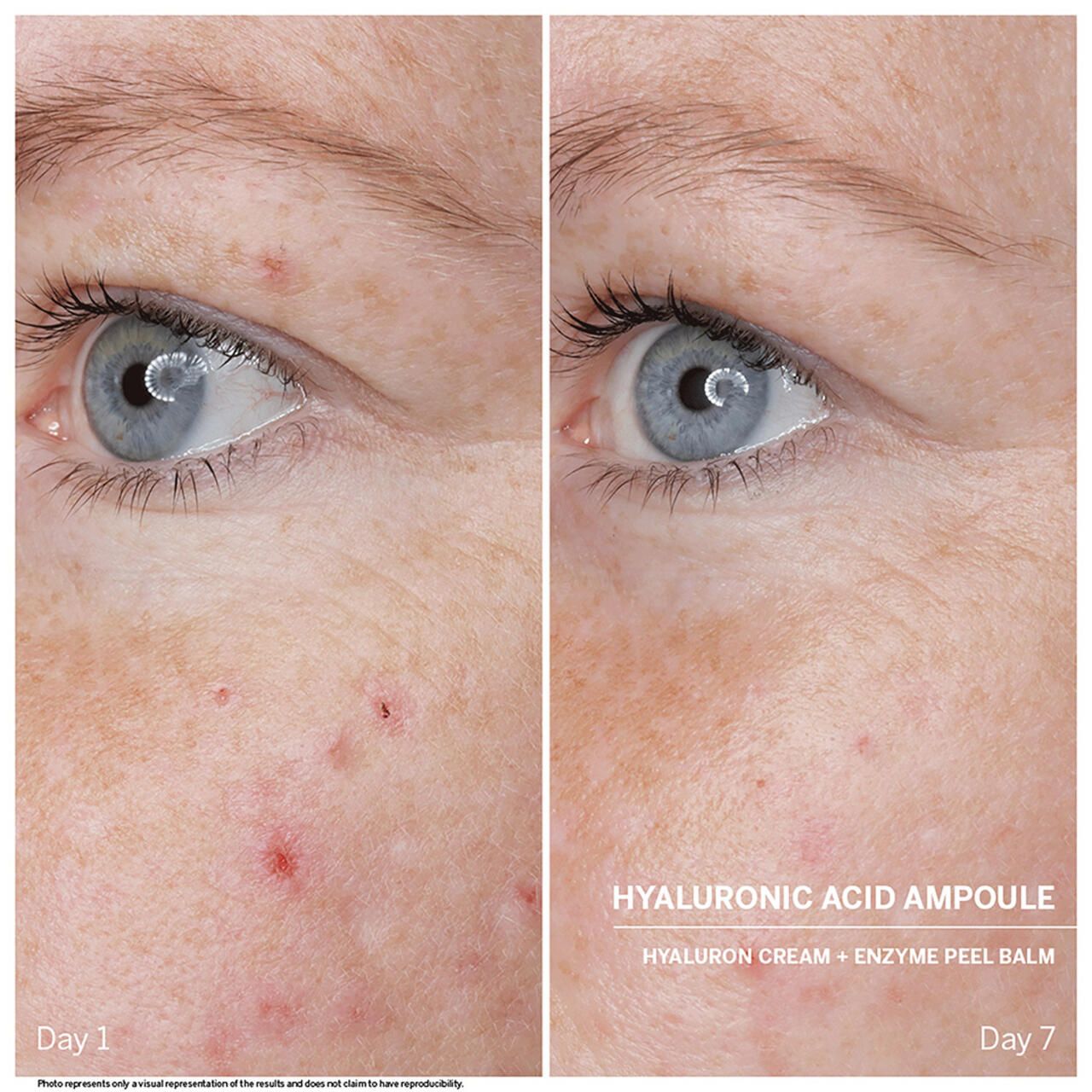 Babor, Doctor Babor Power Serum Hyaluronic Acid