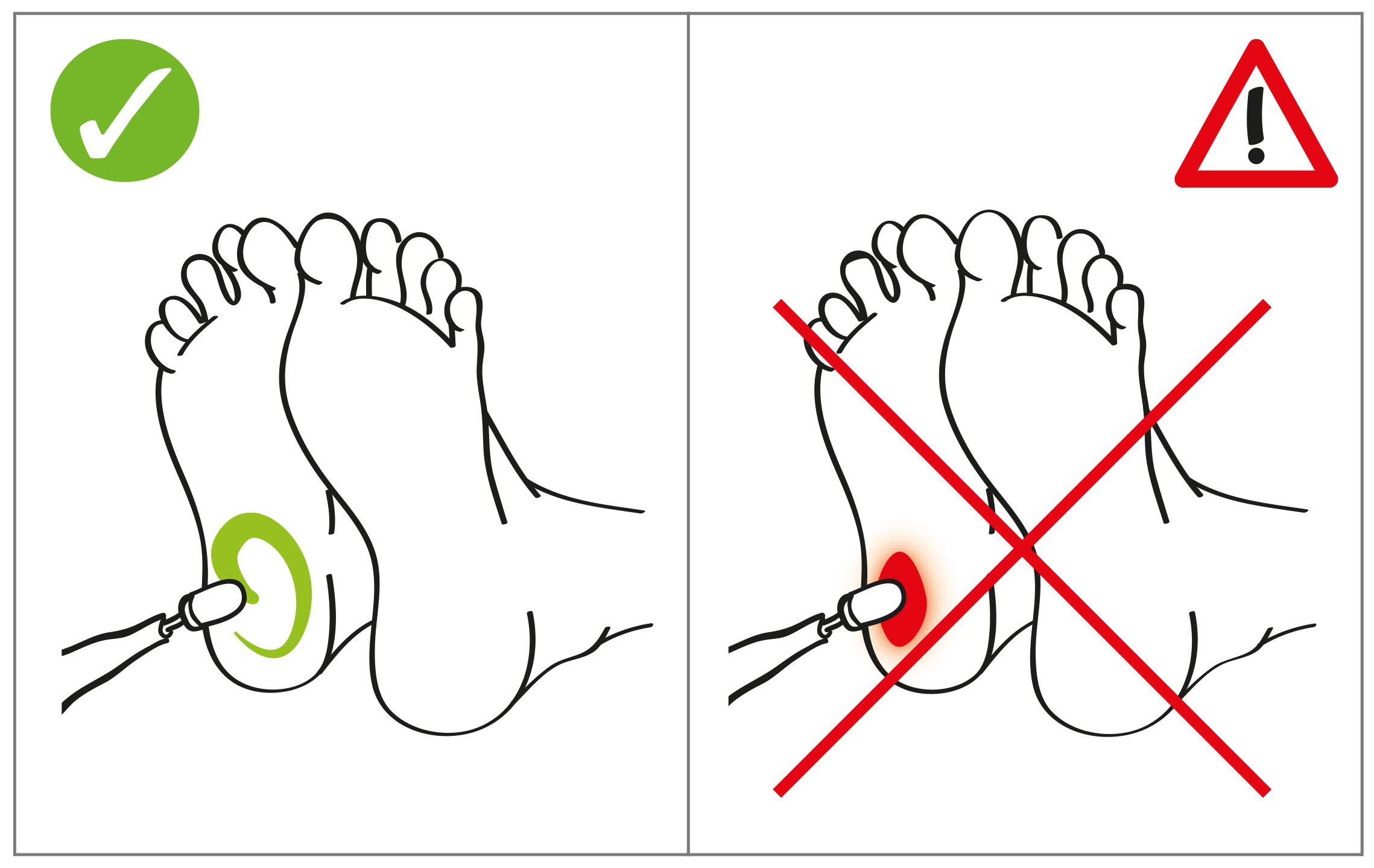 Peter Bausch THERMO Schleifkappen