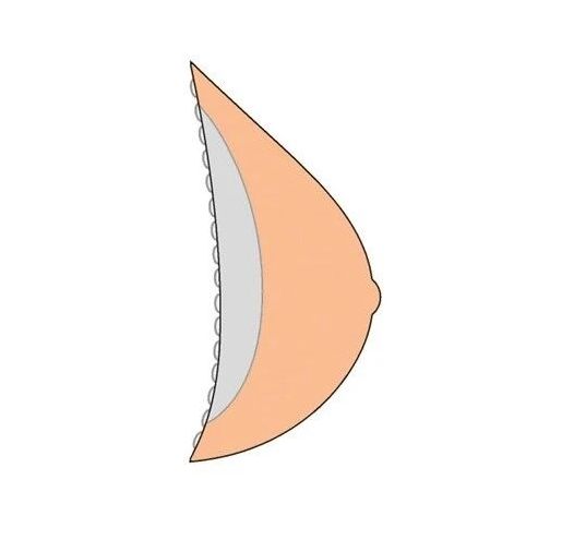 Seitenansicht einer Brustprothese. Hautfarben, mit abgerundeter Form und geriffelter Kante.