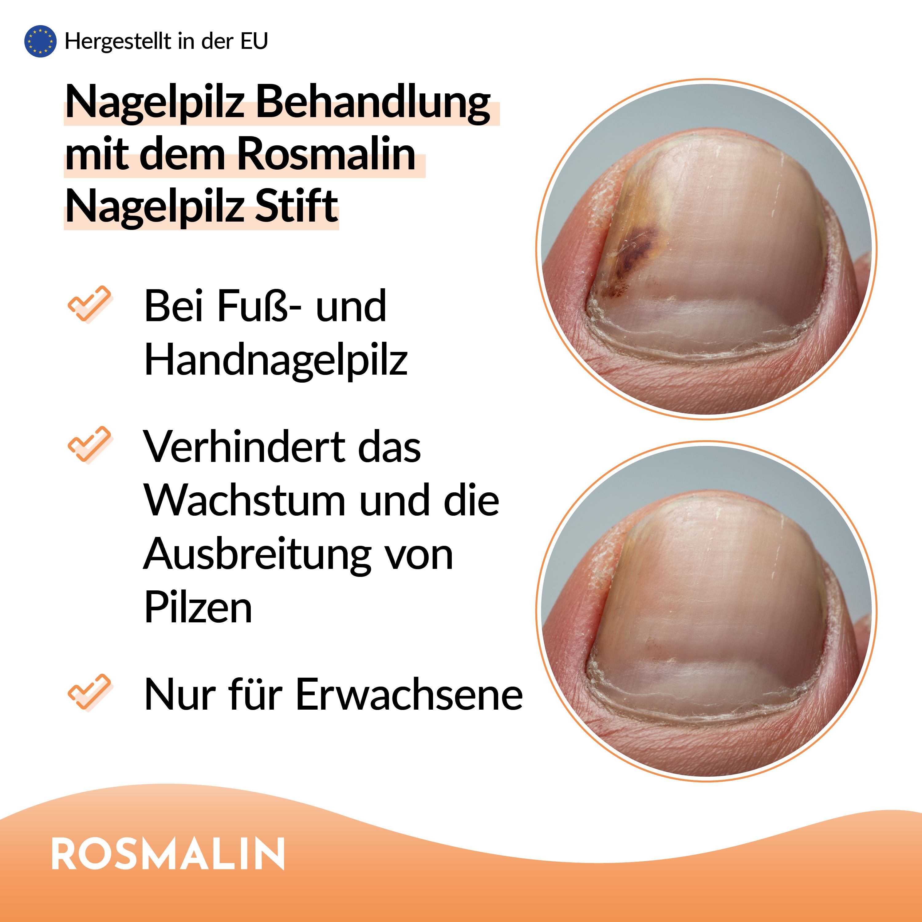 Rosmalin® Nagelpilz Stift