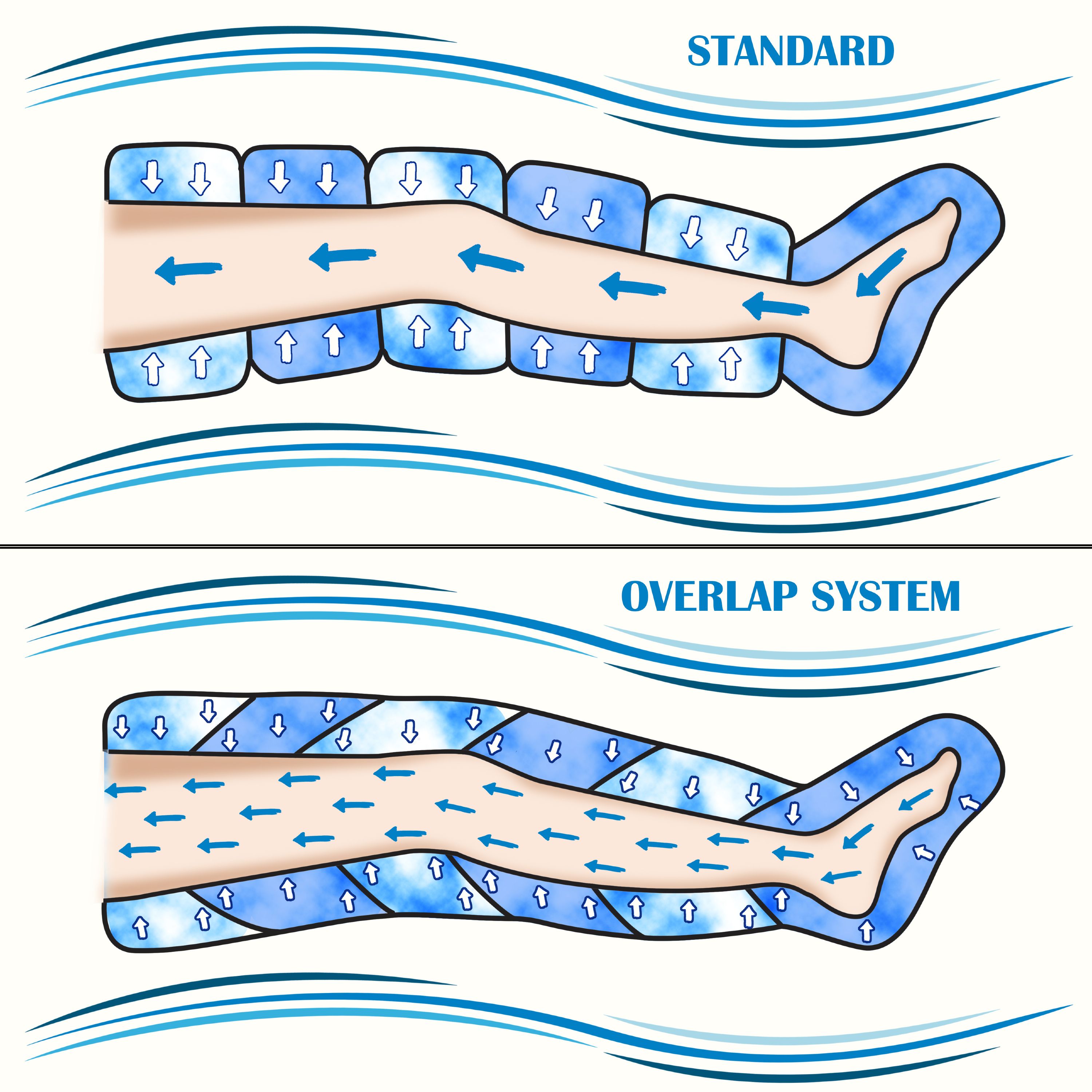 Illustration zeigt zwei Beinwickel-Systeme: Standard und Überlappungssystem. Pfeile zeigen Luftstrom.