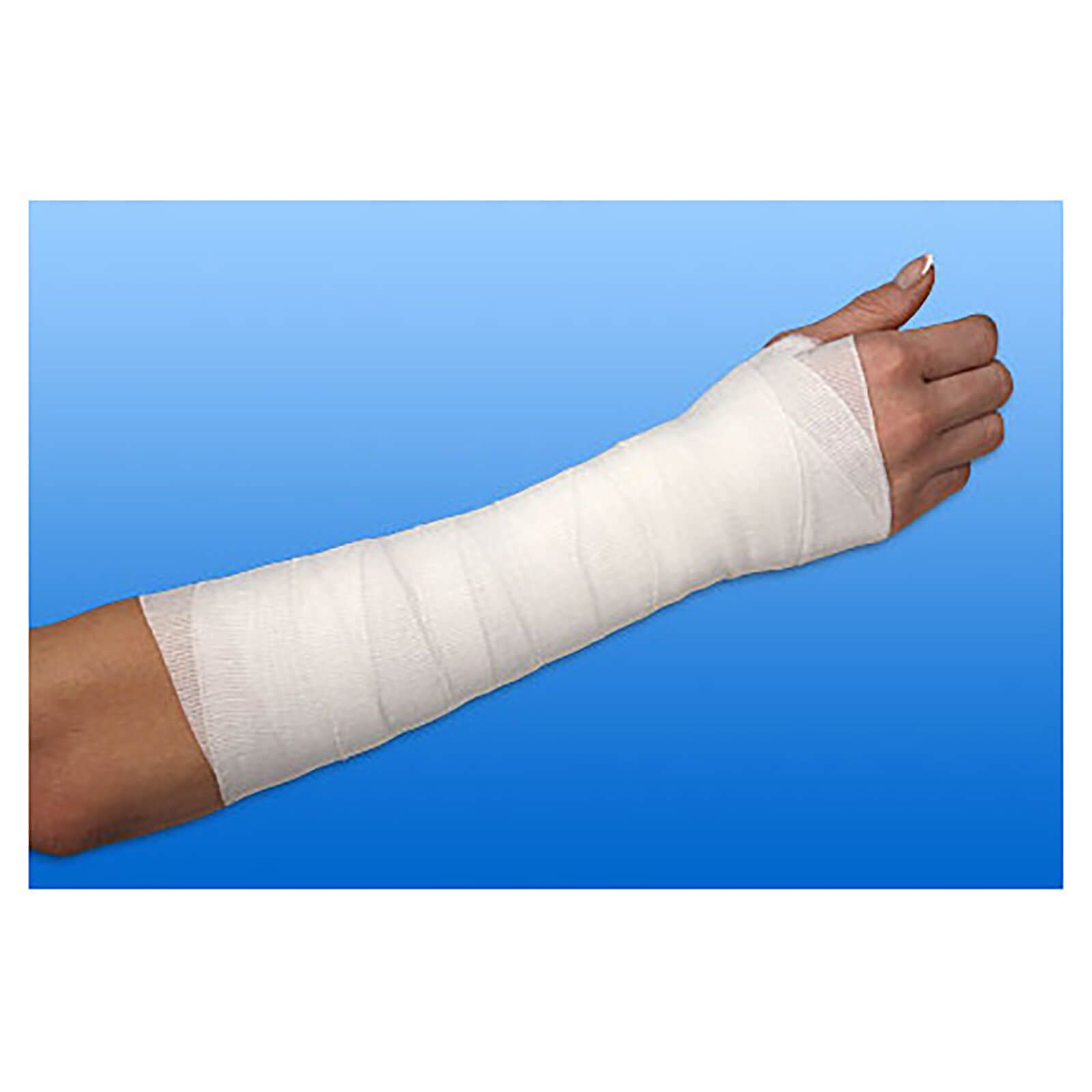 Arm mit weißer Mittelzugbinde gewickelt. Handgelenk und Unterarm bandagiert. Hintergrund blau.