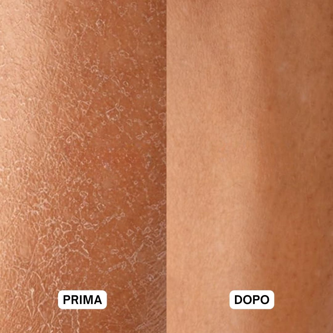 Due immagini della pelle: prima e dopo. Prima: pelle secca. Dopo: pelle liscia.