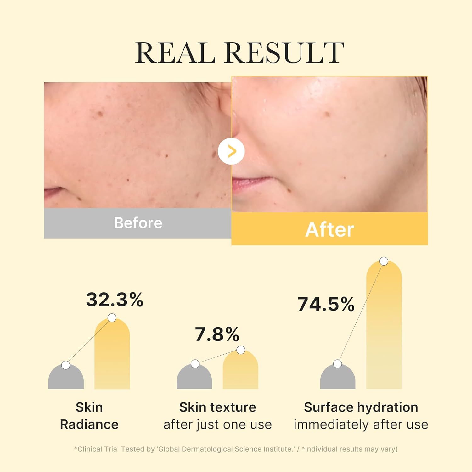 medicube Kojic Acid Turmeric Brightening Gel Mask 4er Pack