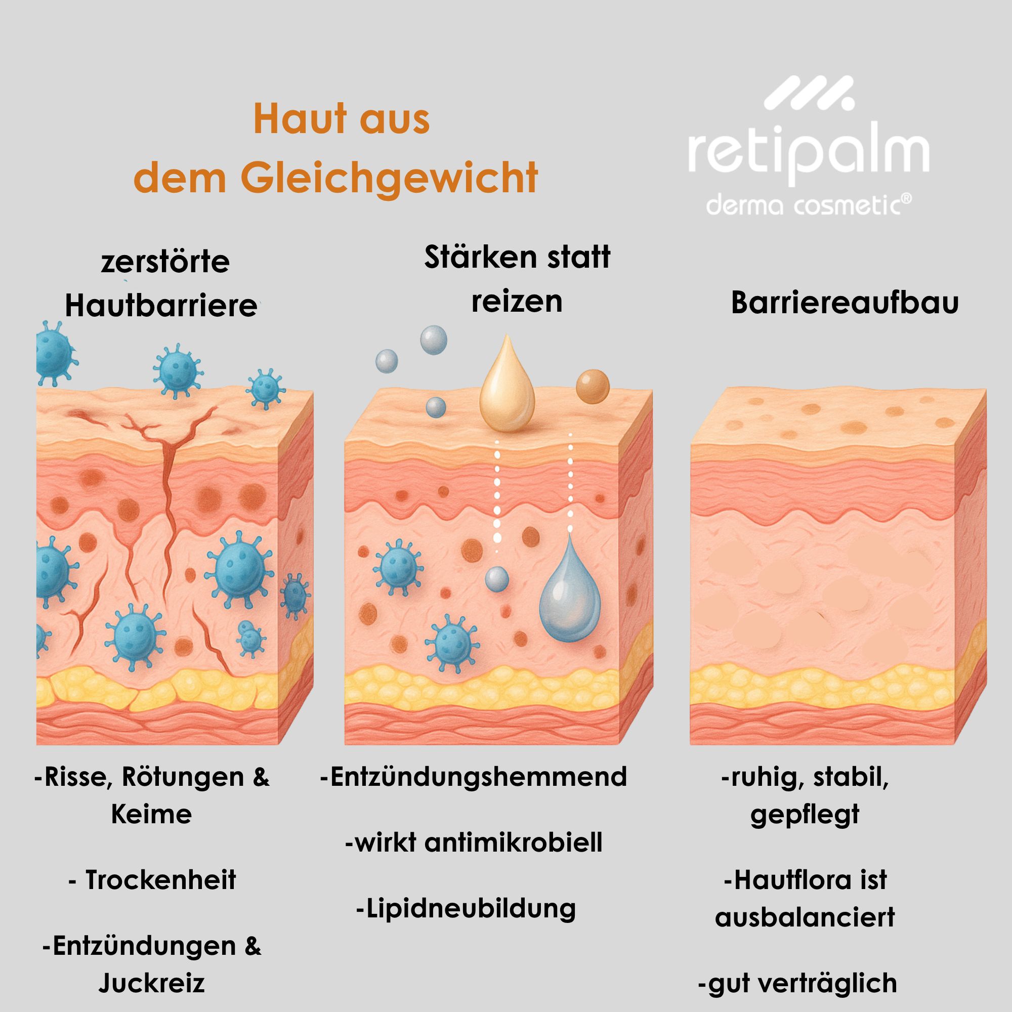 Hautschichten-Illustration: gestörte Hautbarriere, Stärkung der Haut, Barriereaufbau.