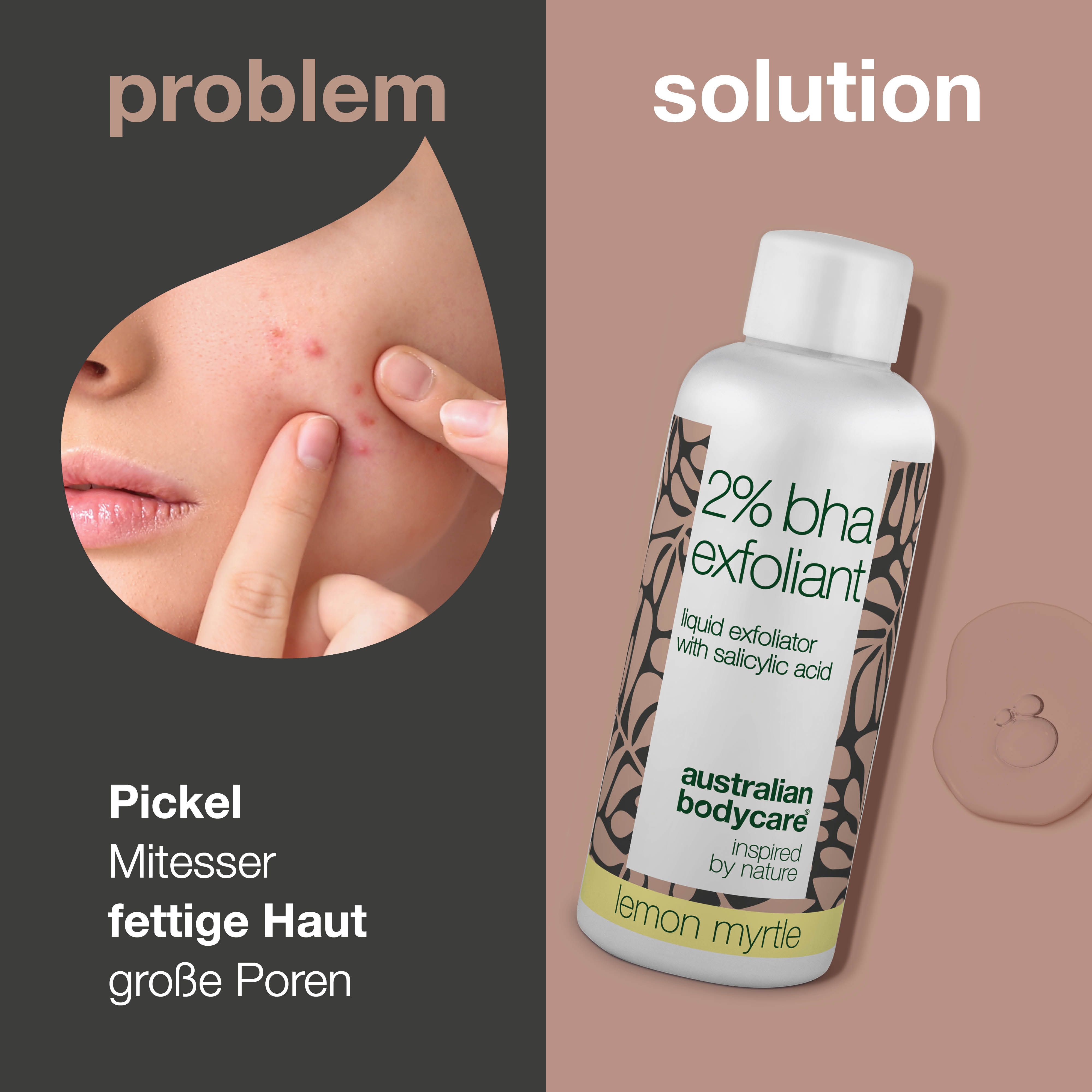 Vergleich: Gesicht mit Pickeln vs. Flasche mit „2% BHA“. Text: Pickel, fettige Haut, große Poren. Marke: Australian Bodycare.