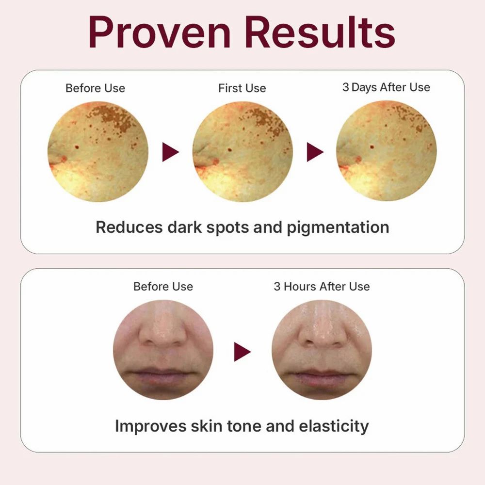 Texttafel mit Vorher-Nachher-Bildern. Reduzierung von dunklen Flecken und Verbesserung der Haut.