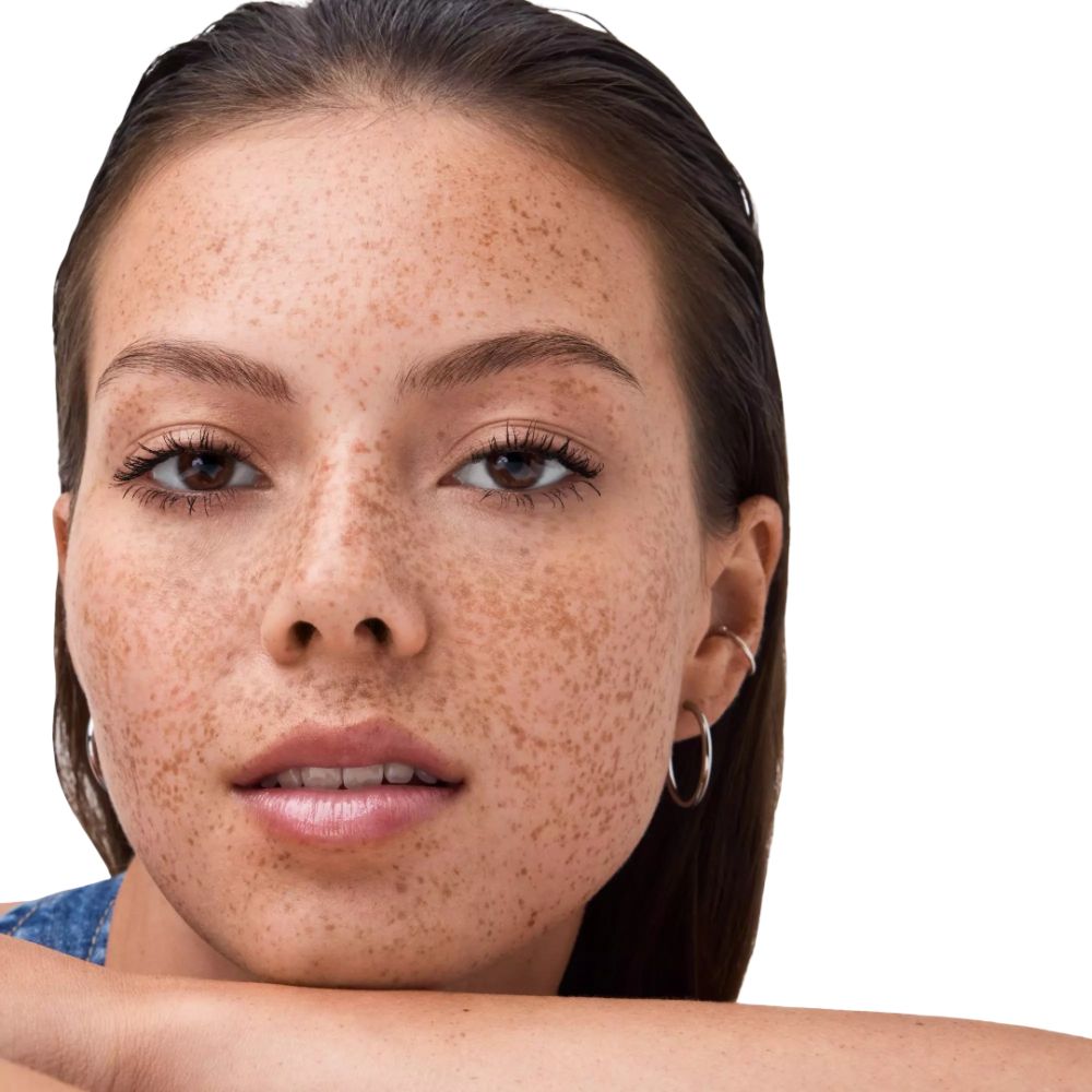 Porträt einer jungen Frau mit Sommersprossen im Gesicht und silbernen Ohrringen.