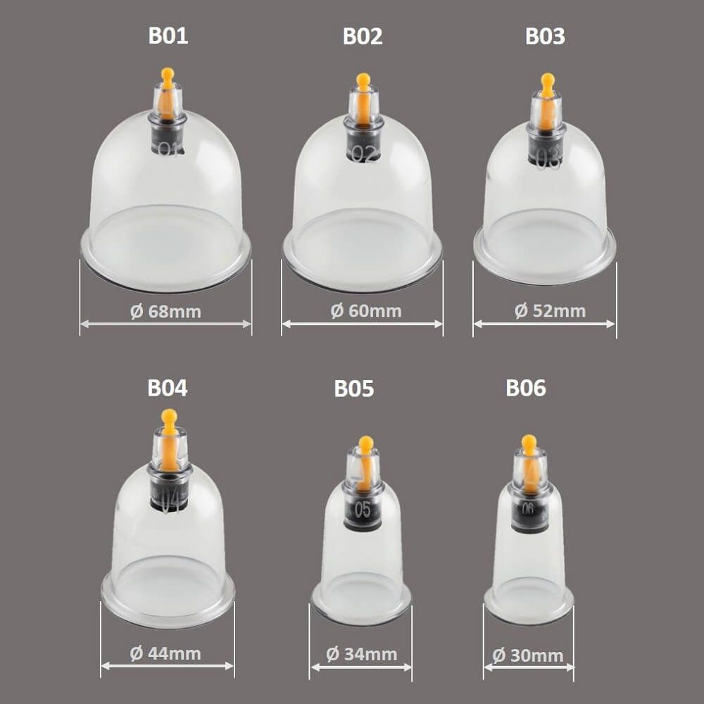 Sechs Schröpfgläser mit Durchmessern von 30mm bis 68mm.