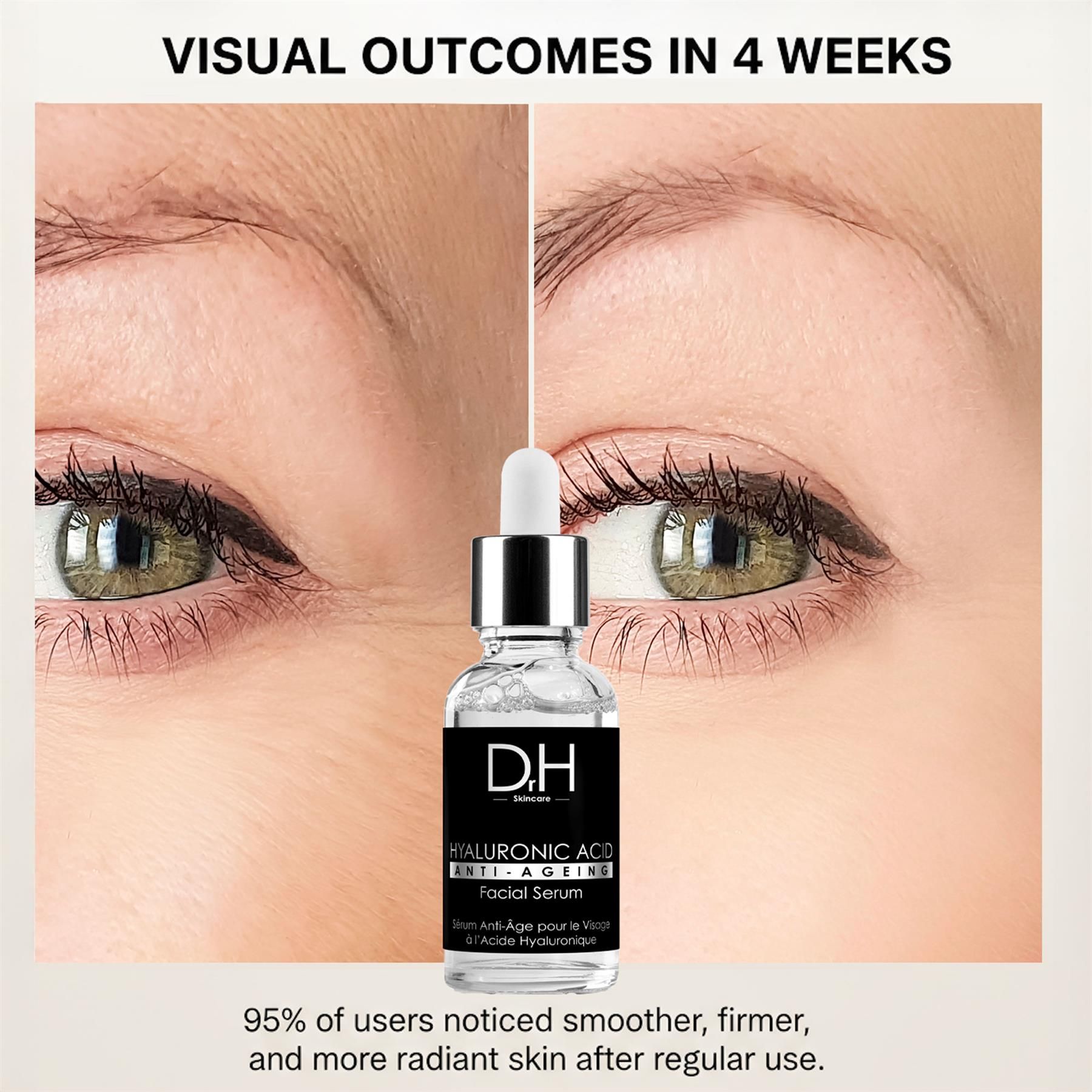 Vorher-Nachher-Vergleich von Hautfalten, mit Dr H Hyaluronsäure Anti-Aging Gesichtsserum in der Mitte.
