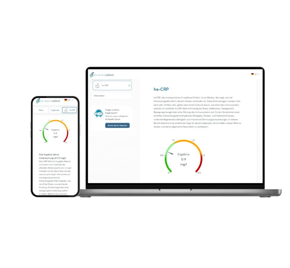 Smartphone und Laptop mit Testergebnissen. Farbskala und Text.