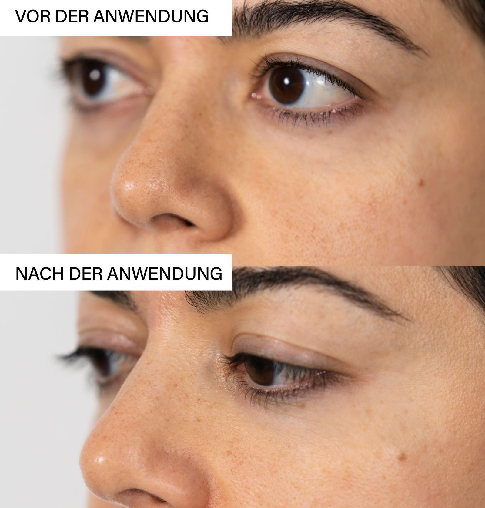 Zwei Nahaufnahmen von Augenpartien. Oben: Vor der Anwendung. Unten: Nach der Anwendung. Text.