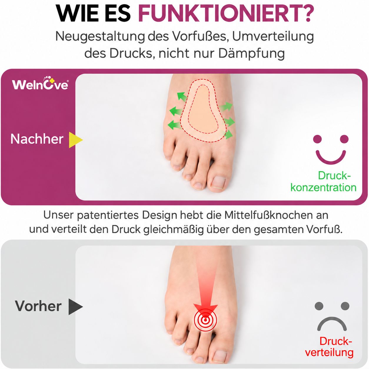 Welnove Leder-Vorfußpolster