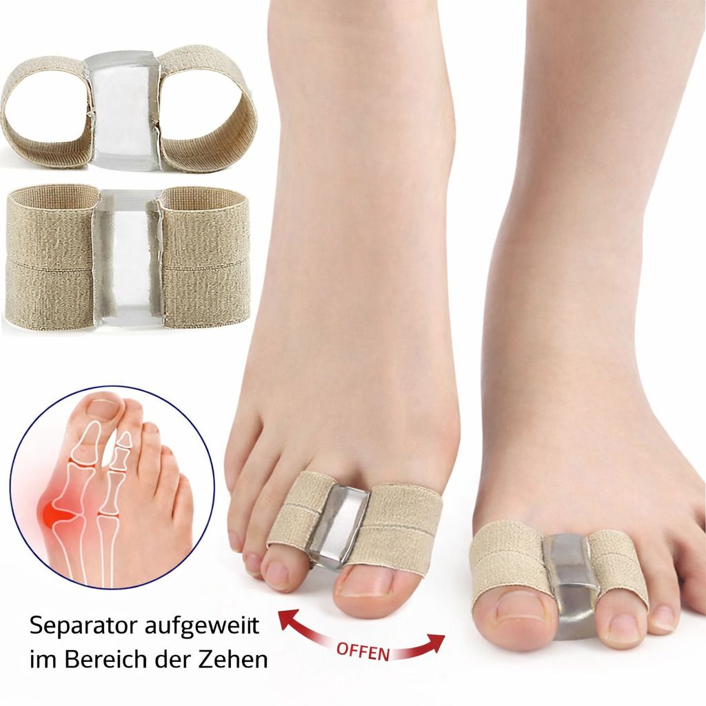 Zehenspreizer mit Band. Beige Bandagen mit Silikon-Zehentrennern. Anatomische Darstellung des Fußes mit Hallux Valgus.