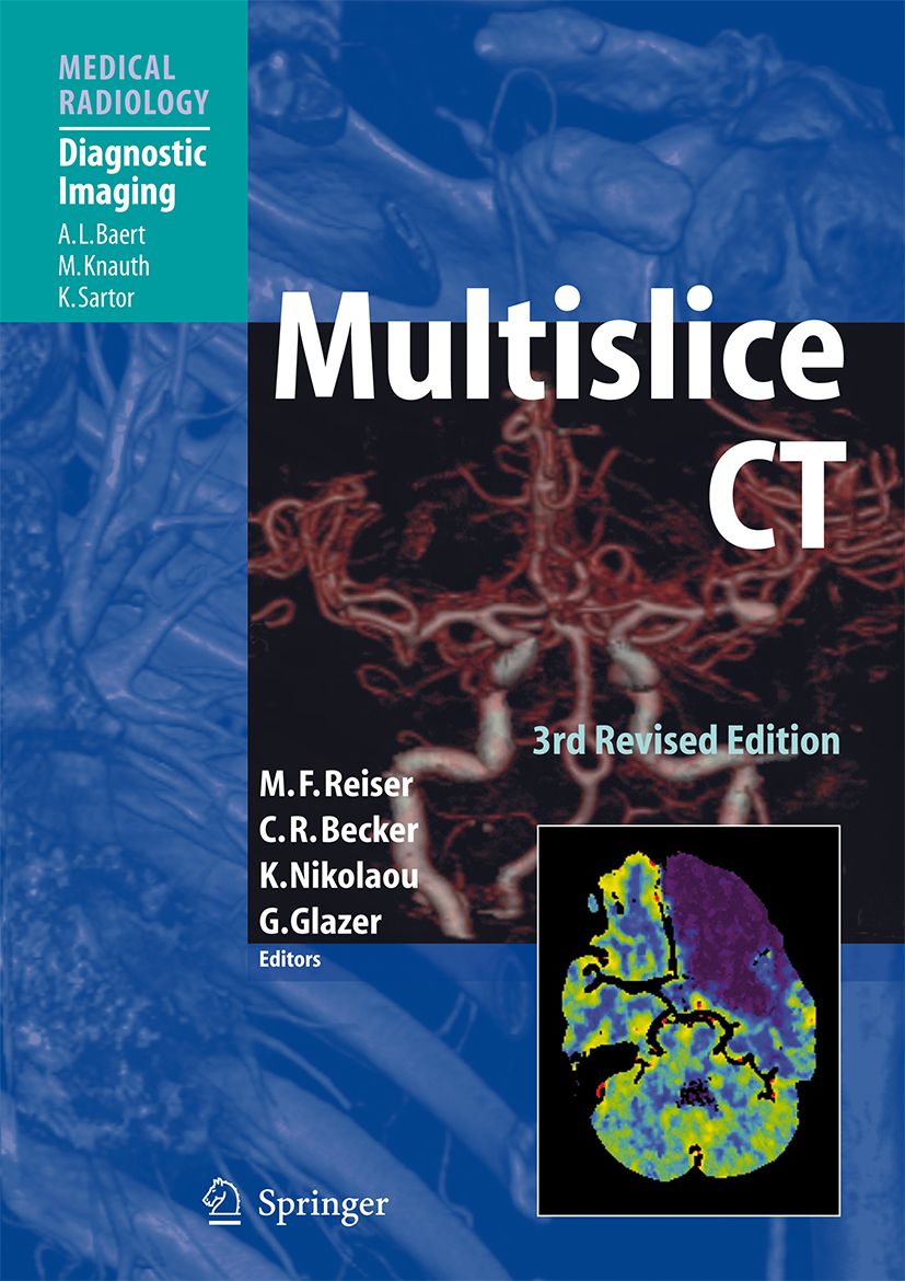 Buchcover "Multislice CT". Titel in Weiß. Autoren und Herausgeber sind aufgeführt. Springer-Logo unten links. Abbildung eines CT-Scans.