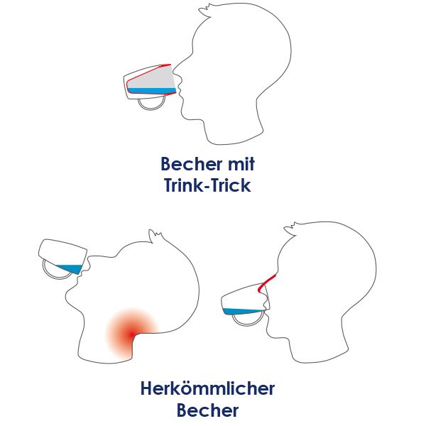 Grafische Darstellung: Becher mit Trink-Trick, herkömmlicher Becher. Illustrationen zeigen Trinkpositionen.
