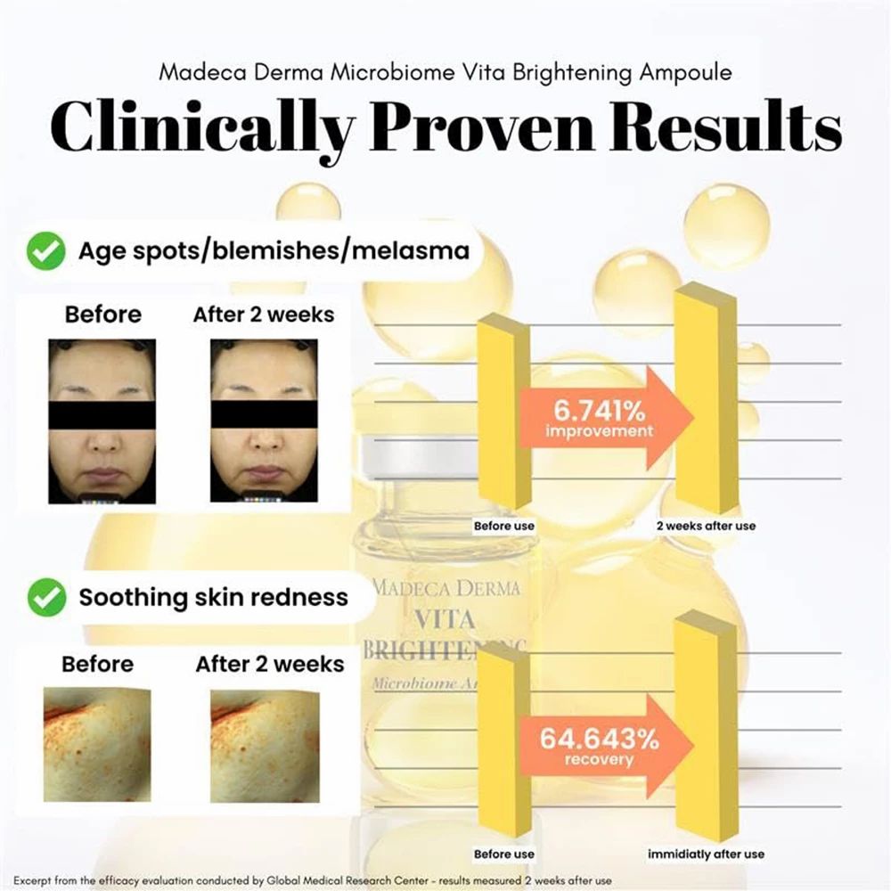 Grafik mit Vorher-Nachher-Bildern von Hautunreinheiten und Rötungen. MADECA DERMA VITA BRIGHTENING Ampulle im Hintergrund.