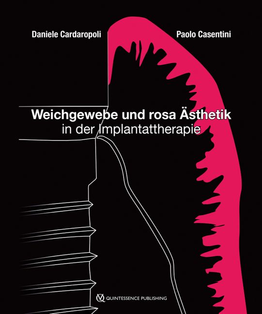 Buchcover mit Titel: Weichgewebe und rosa Ästhetik in der Implantattherapie. Autoren: Daniele Cardaropoli, Paolo Casentini. Verlag: Quintessenz Publishing.