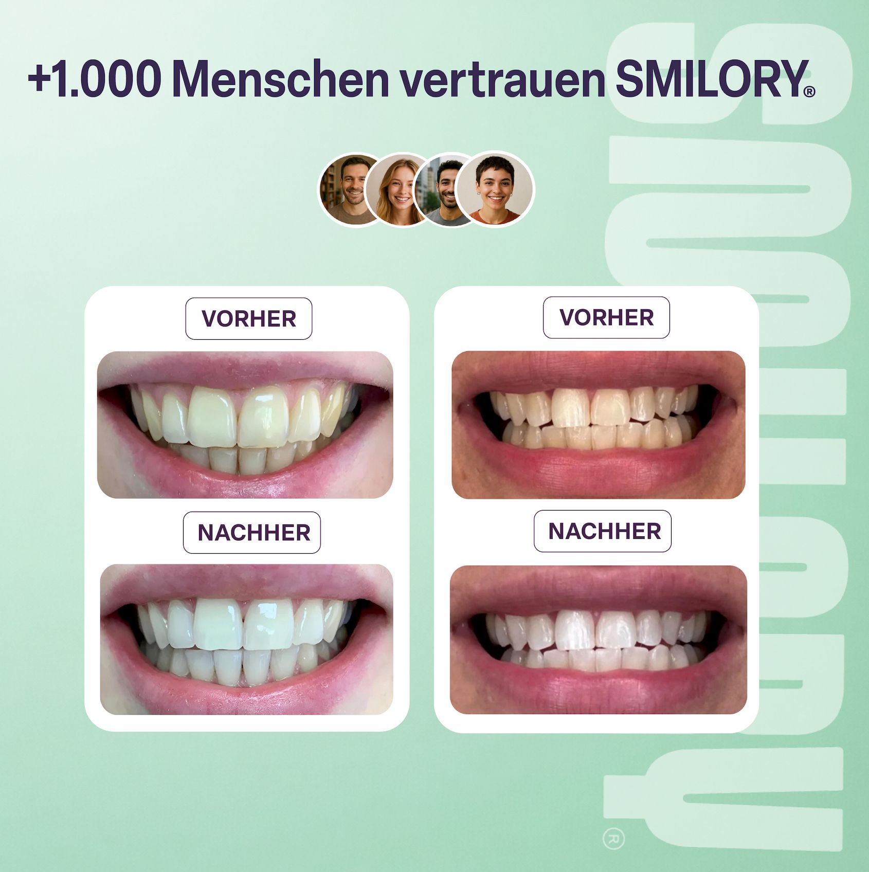 Vorher-Nachher-Vergleich von Zähnen. Vier Bilderpaare zeigen die Aufhellung. Text: +1.000 Menschen vertrauen SMILORY®.