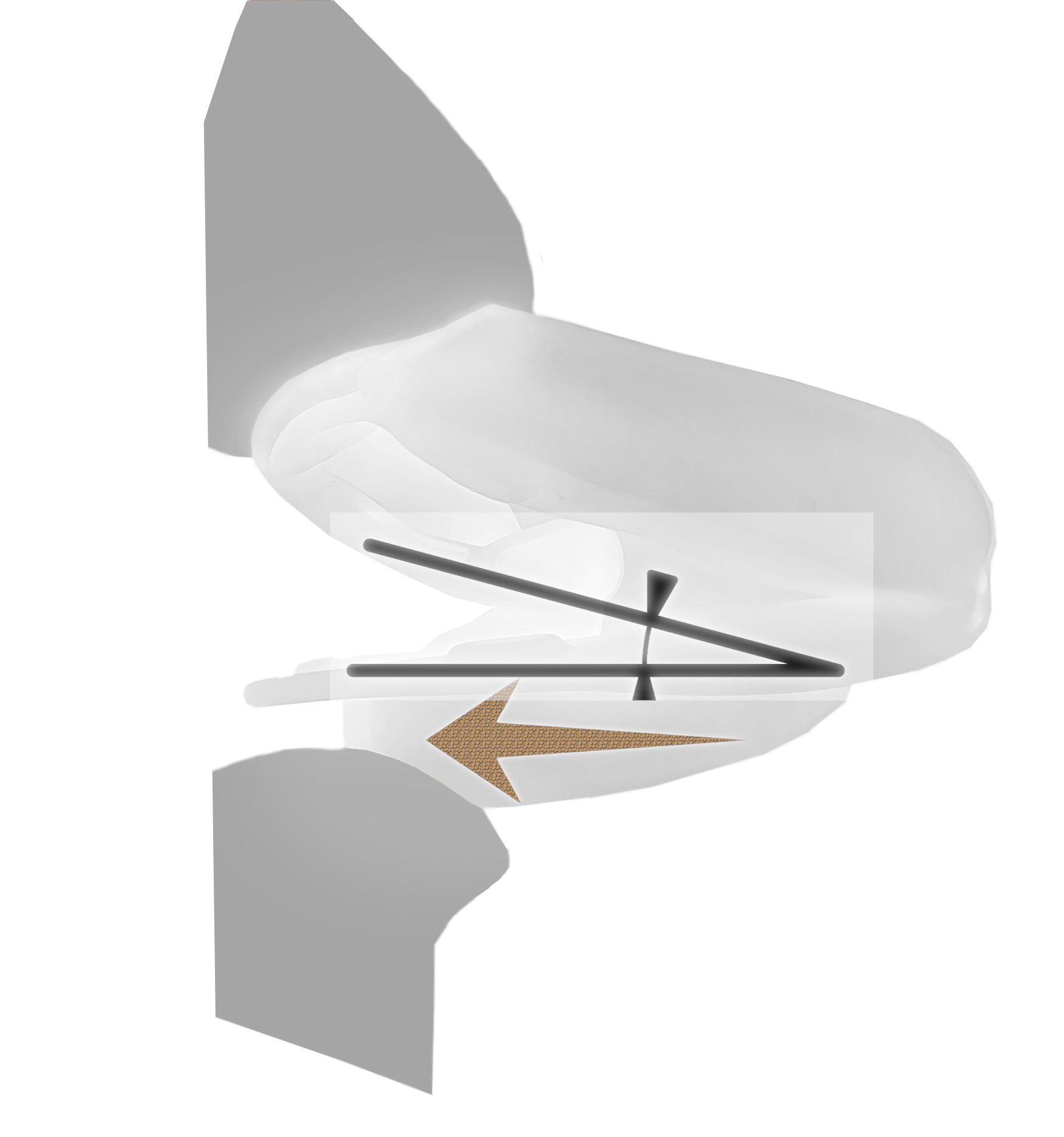 Diagramm einer Unterkieferprotrusionsschiene. Pfeil zeigt die Bewegung an. Weißes Material.