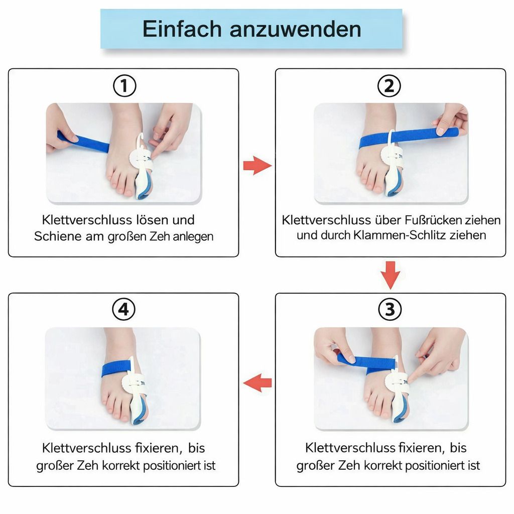 Anleitung zur Anwendung der Hallux-Nachtbandage. 4 Schritte mit Bildern. Text: Einfach anzuwenden. Klettverschluss lösen, anlegen, fixieren.