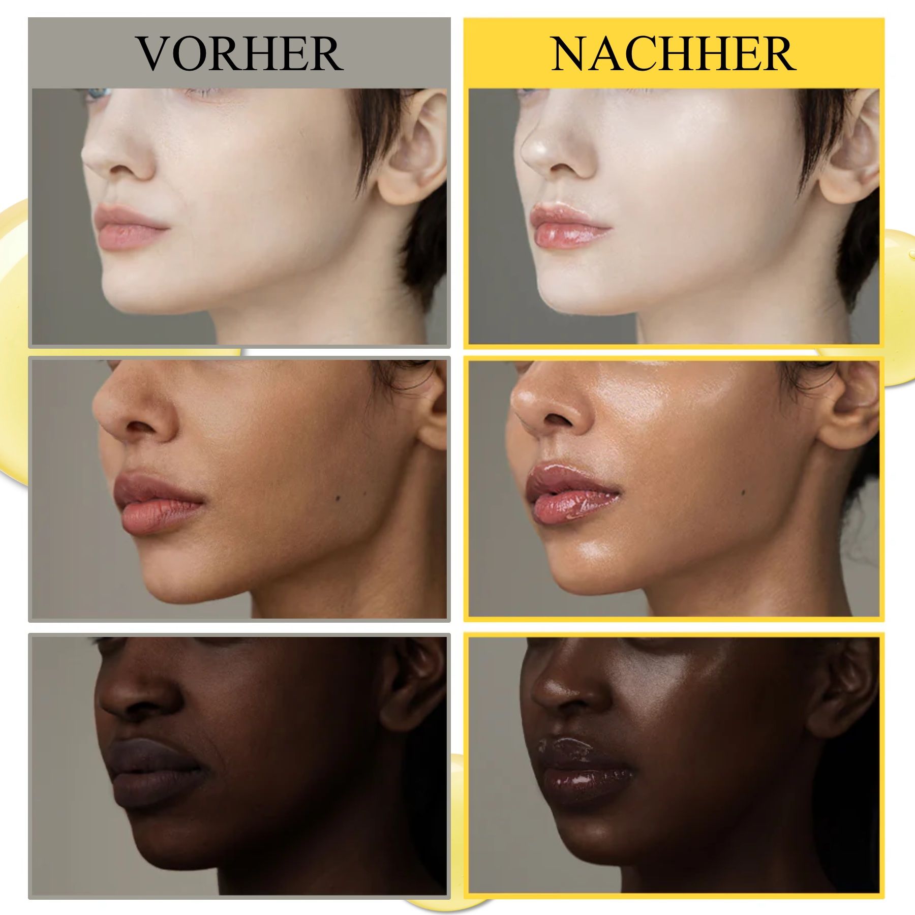 Vorher-Nachher-Vergleich von Gesichtern. Text: Vorher, Nachher. Hautbilder zeigen Unterschiede in Helligkeit und Glanz.