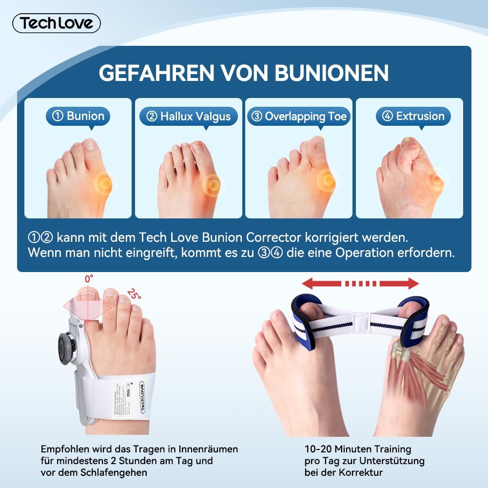 Eine Infografik, die die Gefahren von Ballenzehen und die Verwendung des Tech Love Bunion Correctors zeigt. Sie zeigt verschiedene Stadien von Ballenzehen und wie der Korrektor helfen kann. Es gibt auch Anweisungen zur Verwendung des Korrektors.